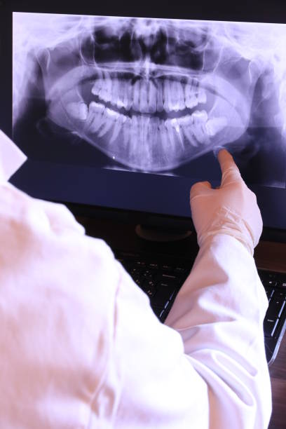 Best Emergency Wisdom Tooth Extraction in Larimore, ND
